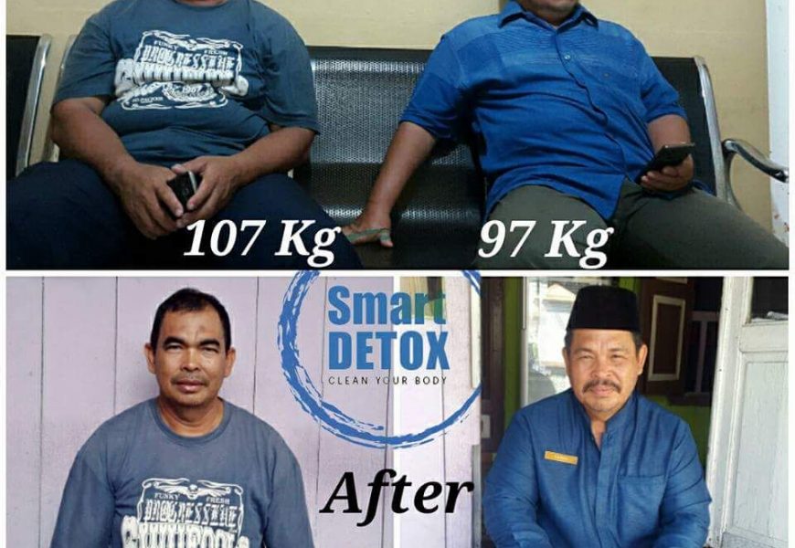 Jual Smart Detox Plus Synergy 2018 di Tasikmalaya Hubungi  087775911529