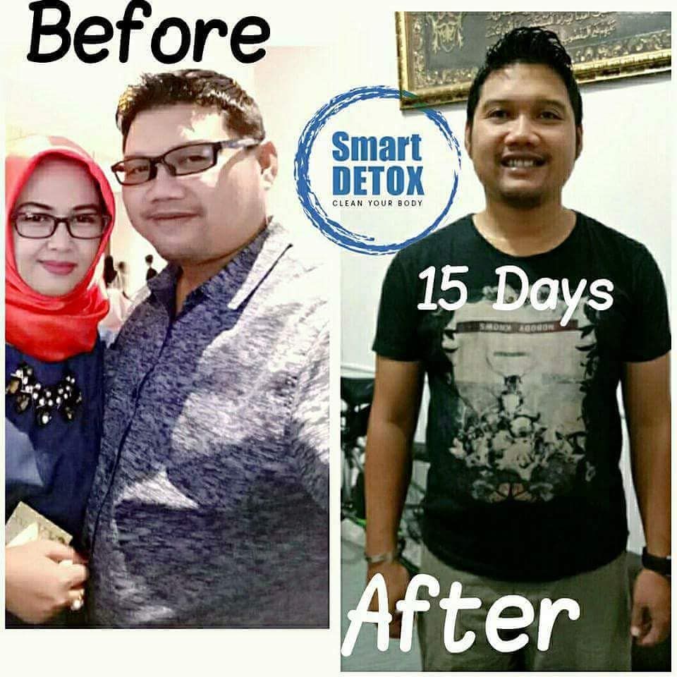 Jual Smart Detox Plus di Langsa Aceh