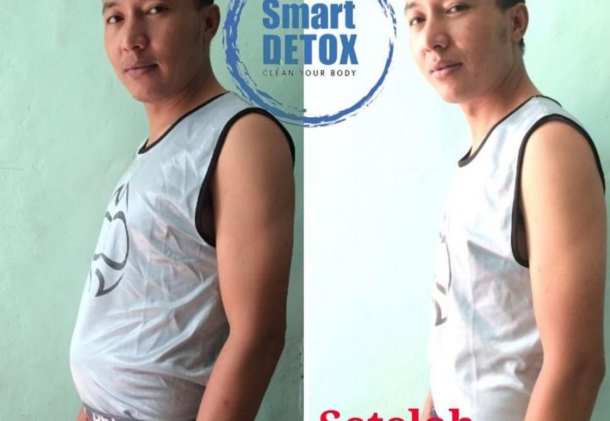 Jual Smart Detox Plus di  Lampung 2018 di Lampung Hubungi  087775911529