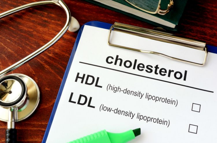 Cara Menjaga Kadar Kolesterol Agar Sesuai Standar Kesehatan Tubuh